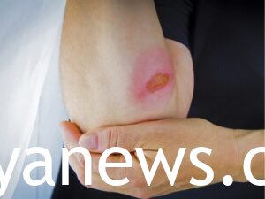 care that is urgent for banner
