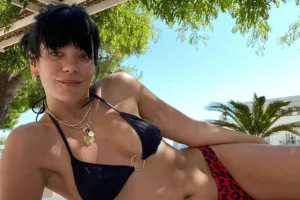 FOR Lily Allen