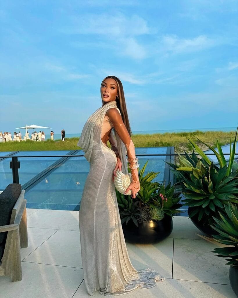 Winnie Harlow:looking good