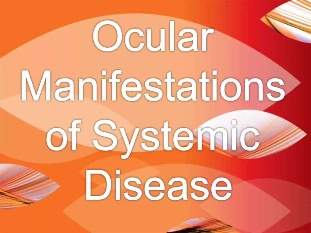 Download Clinical medicine And Systemic Diseases In Optometry Past Paper Exam 8 Download Clinical medicine And Systemic Diseases In Optometry Past Paper Exam Clinical medicine And Systemic Diseases In Optometry Past Paper Exam