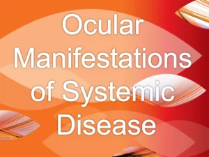 Clinical medicine And Systemic Diseases In Optometry Past Paper Exam